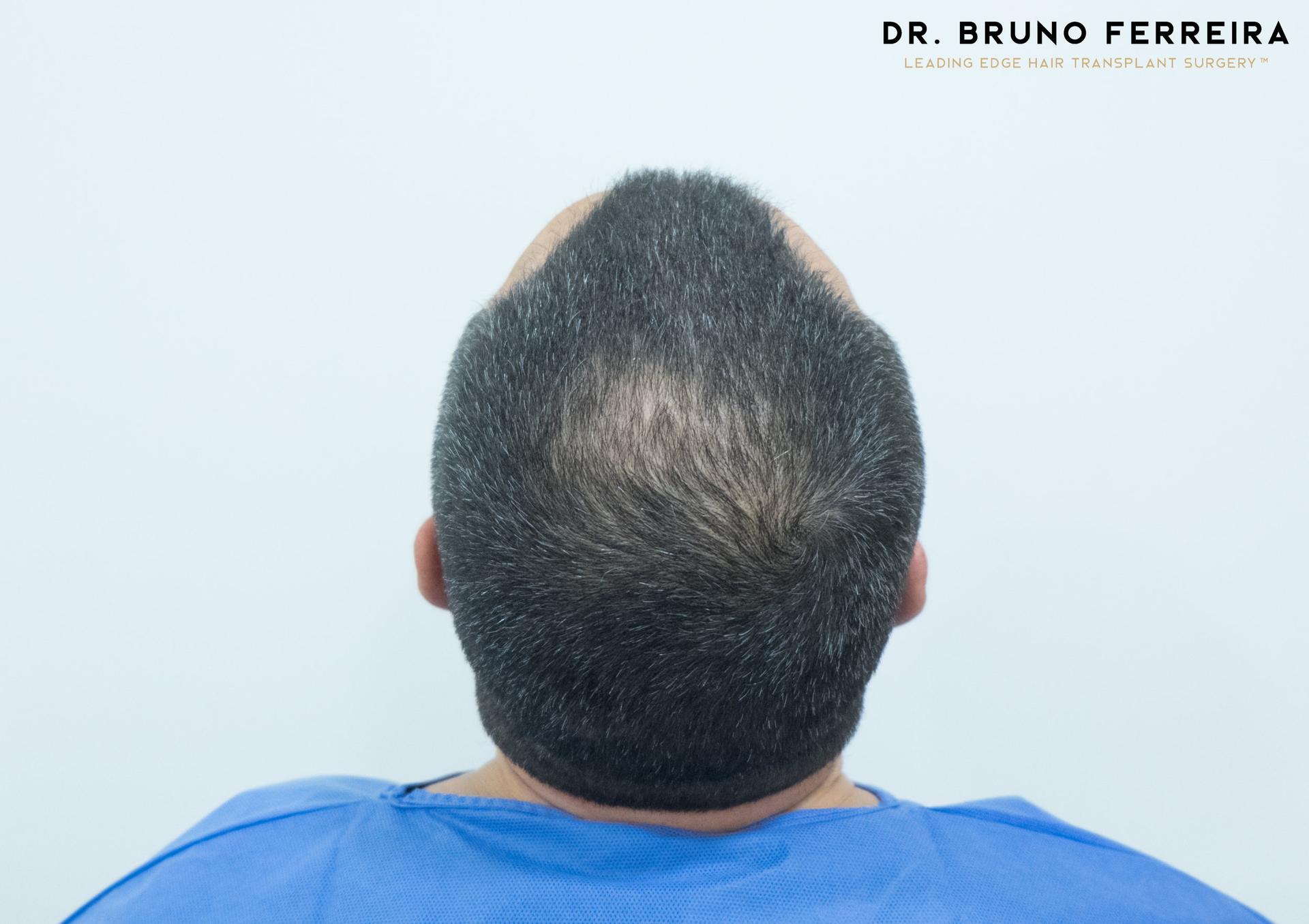 00004+DR.+BRUNO+FERREIRA+(Case+1)+-+Before+-+5