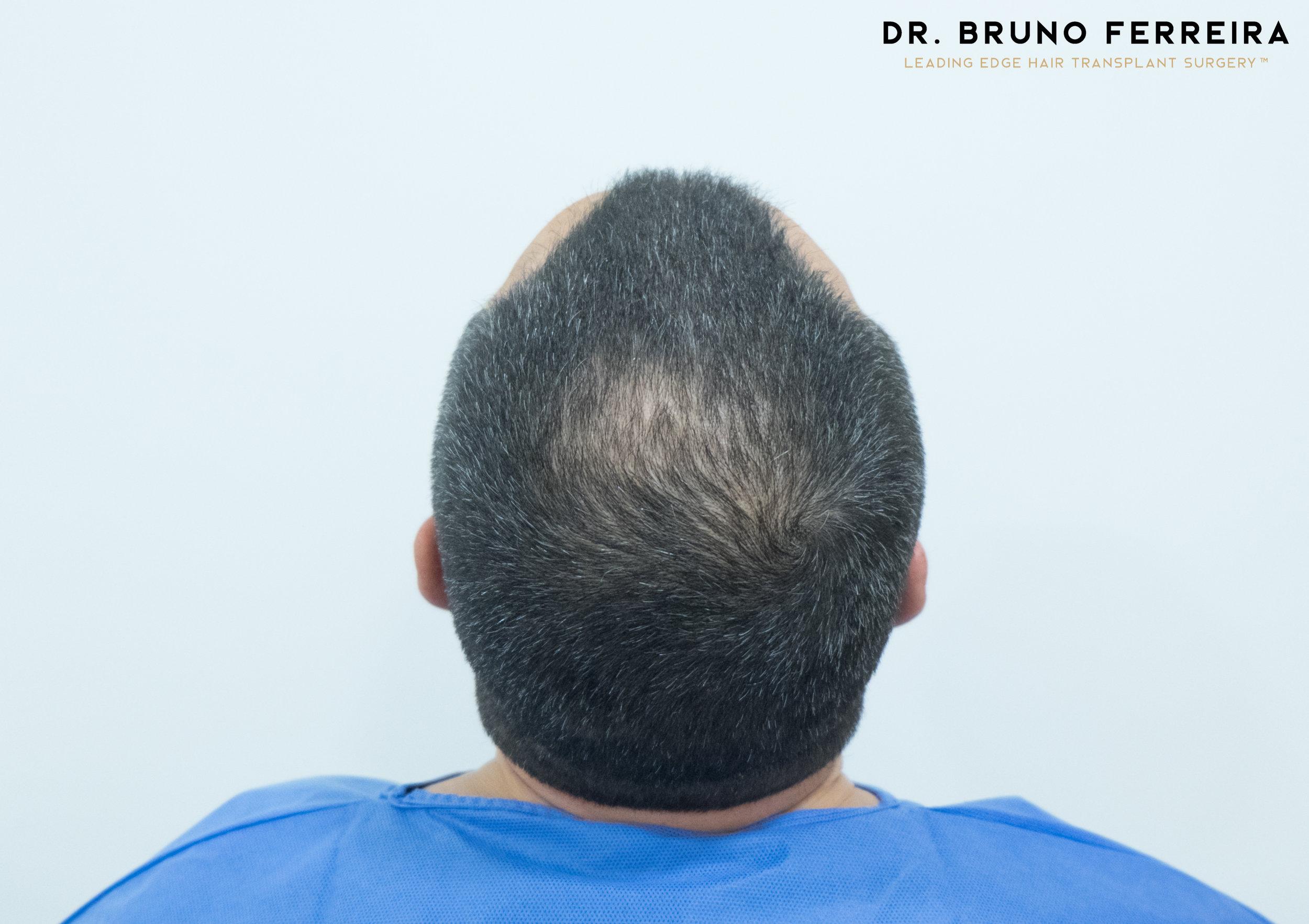 00004+DR.+BRUNO+FERREIRA+(Case+1)+-+Before+-+5