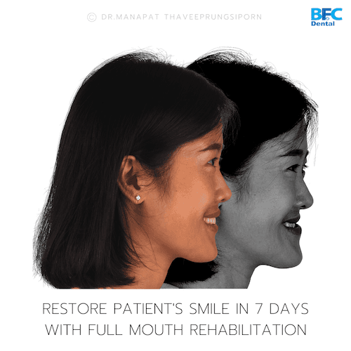 DENTAL ALL ON 4 case-8.2-1