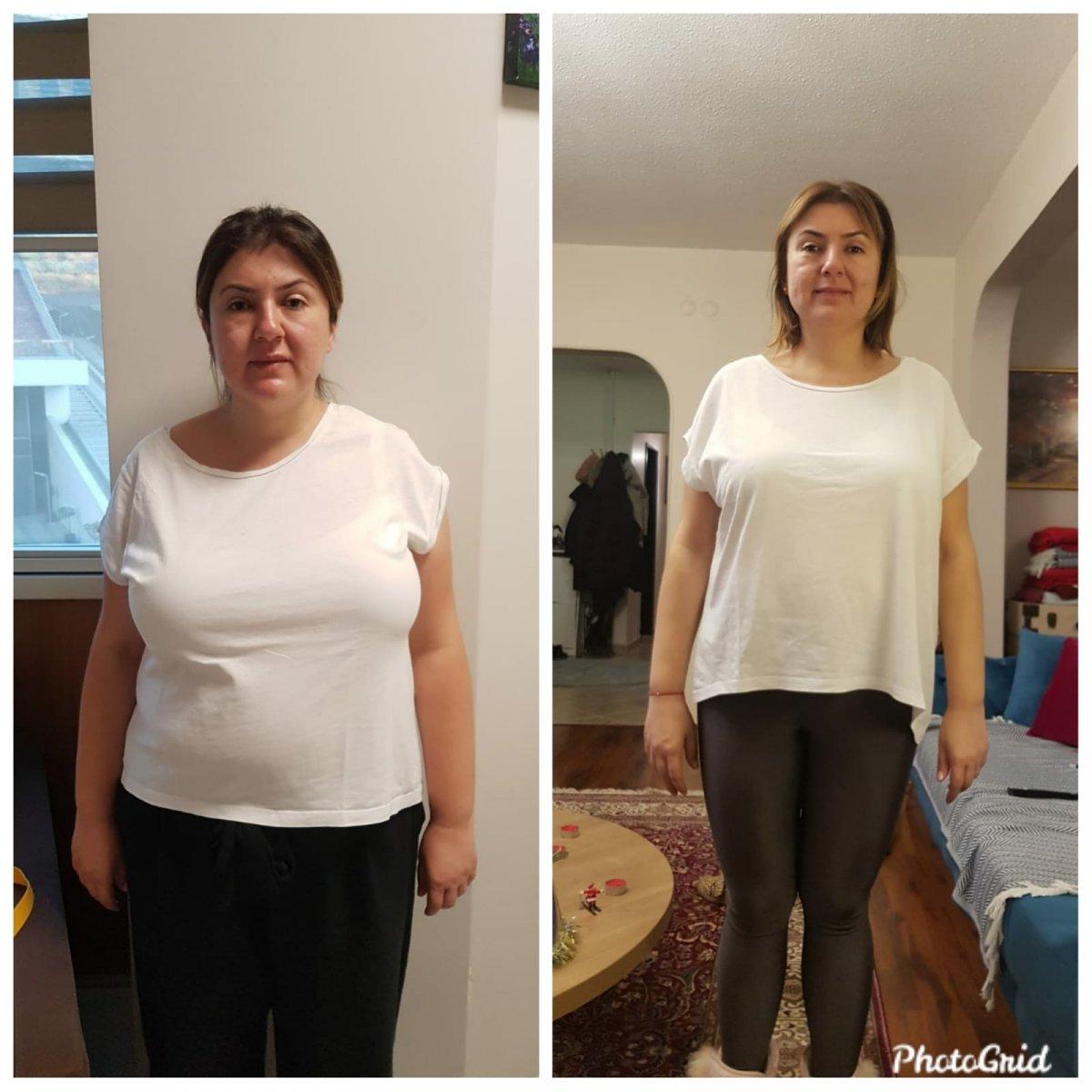 Resultat ballon gastrique