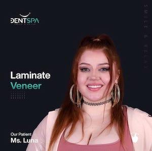 DENTSPA ISTANBUL EMAX VENEERS2