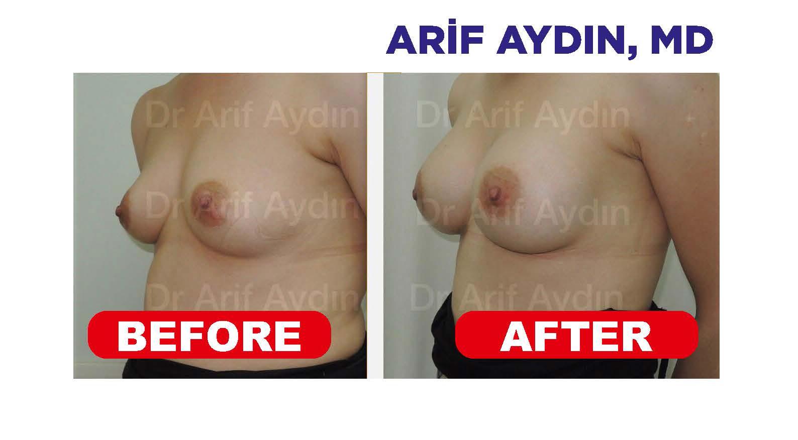 arif aydın_Page_11