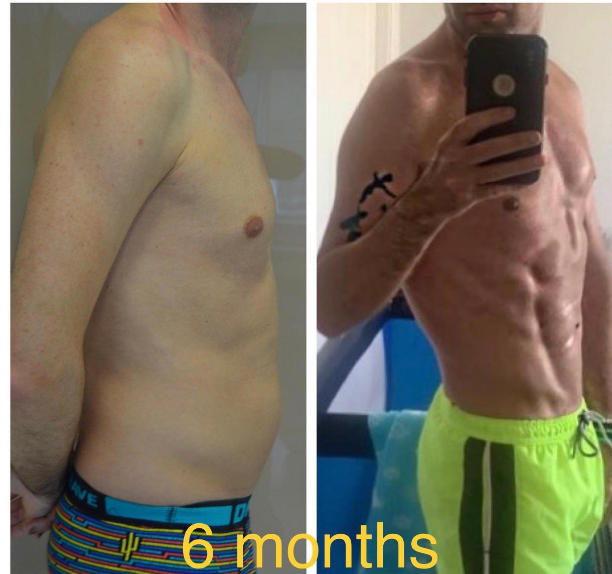 DR Ergin Er LIPO HD lipo6pack
