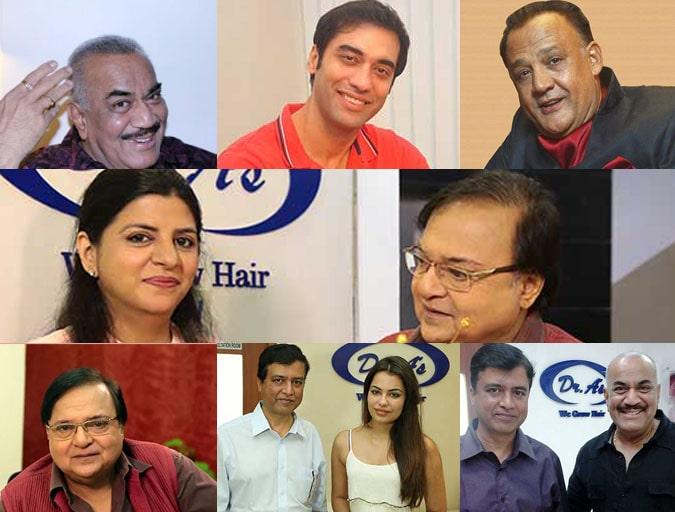 Dr Arvind Poswal hair transplant New Dheli