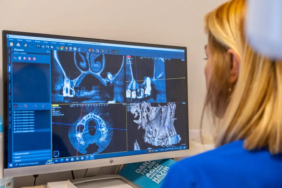 Ultimadent - Dentists in Izmir Turkey 6