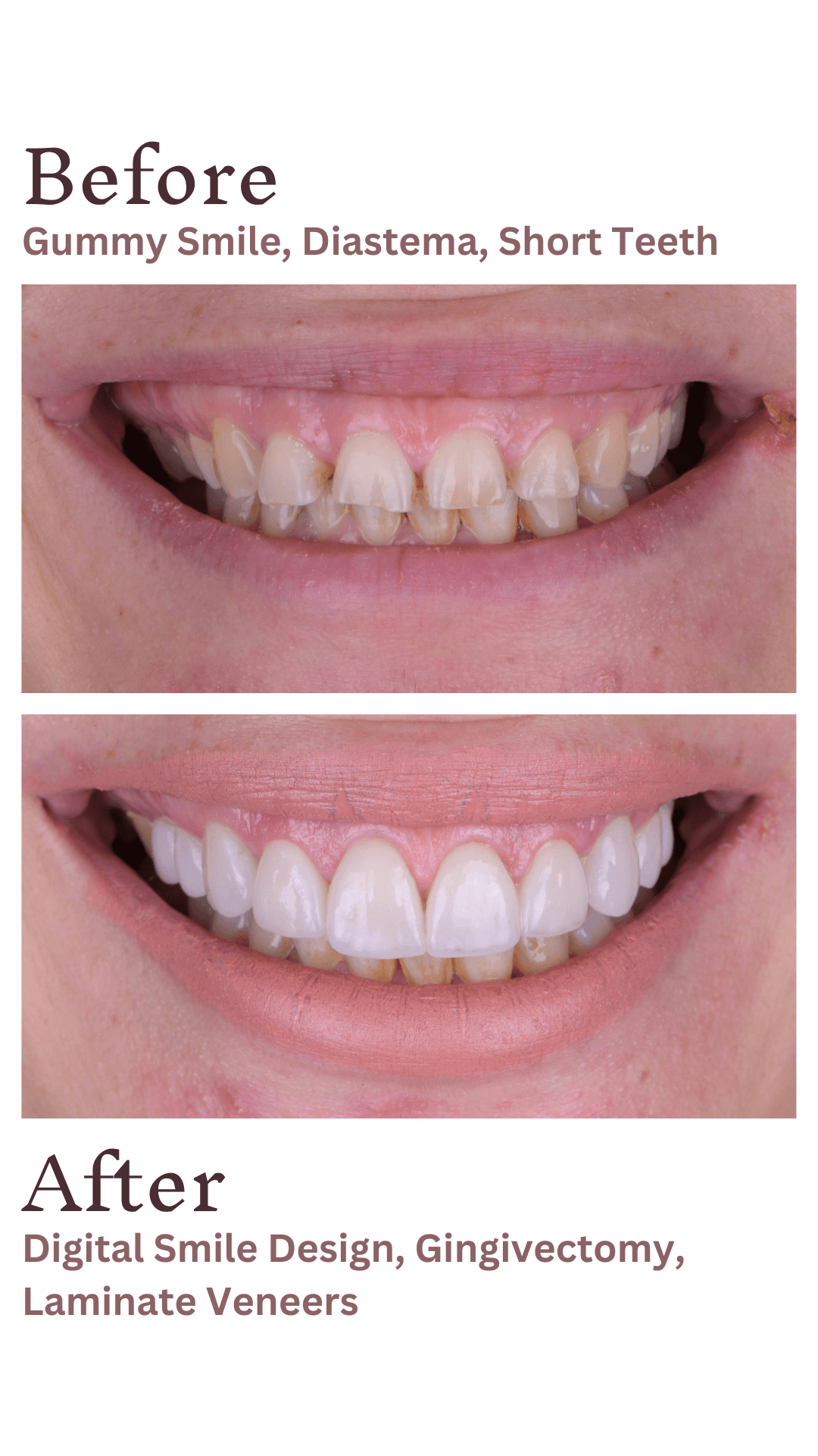 3 G.K Digital Smile Design