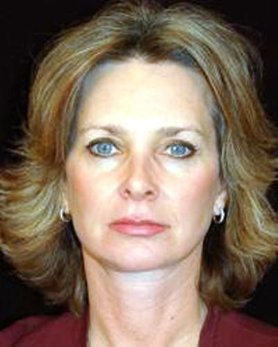 lifting-budapest-apres4