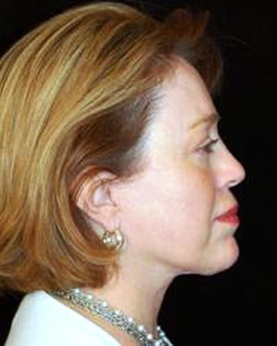 lifting-budapest-apres2