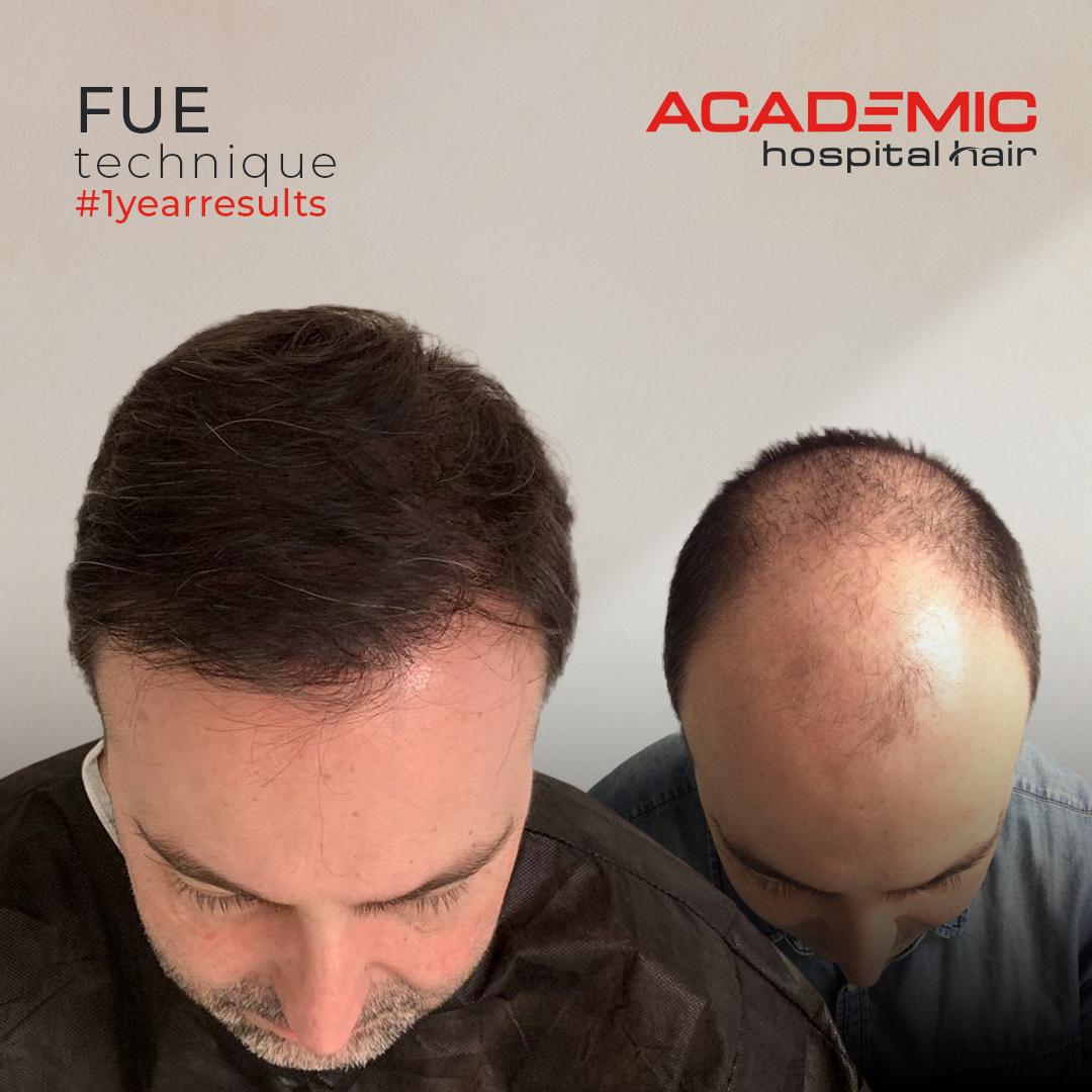 MİGUEL ANGEL SANZ HERNANDEZ_ACIK