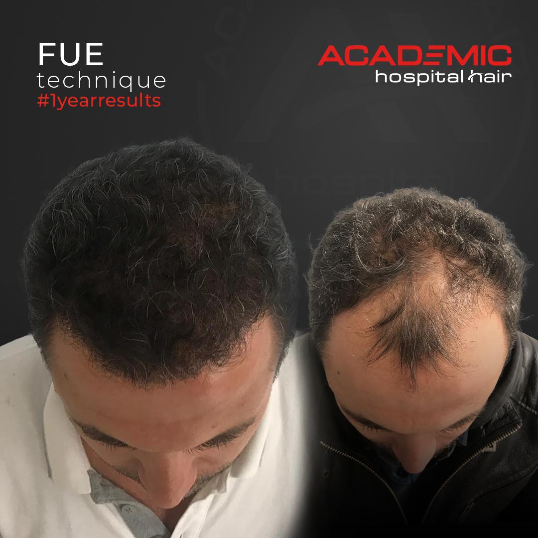 Osman Gok_B-A_KOYU-2