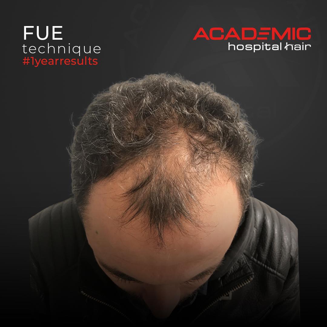 Osman Gok_B-A_KOYU-3