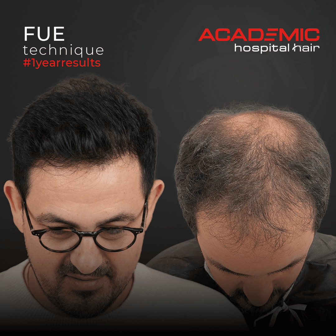 Muhittin_B-A_KOYU (3)