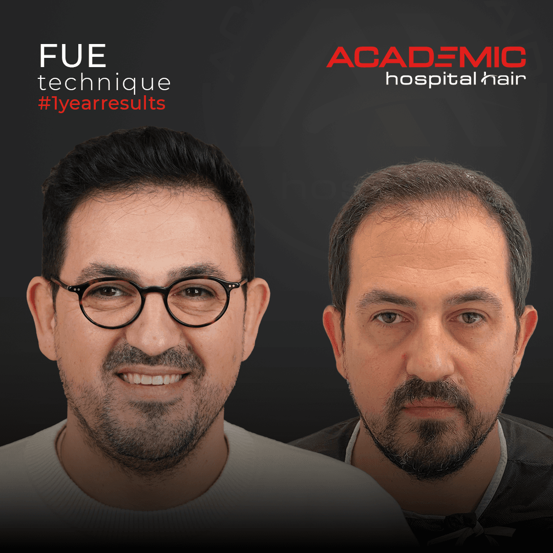 Muhittin_B-A_KOYU1 (1)