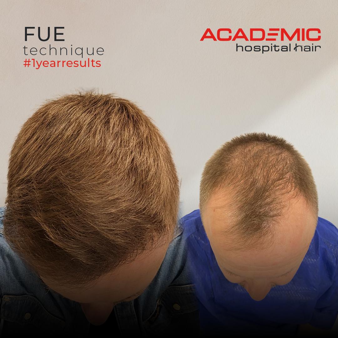 Eugen Koch_DHI_B-A-1