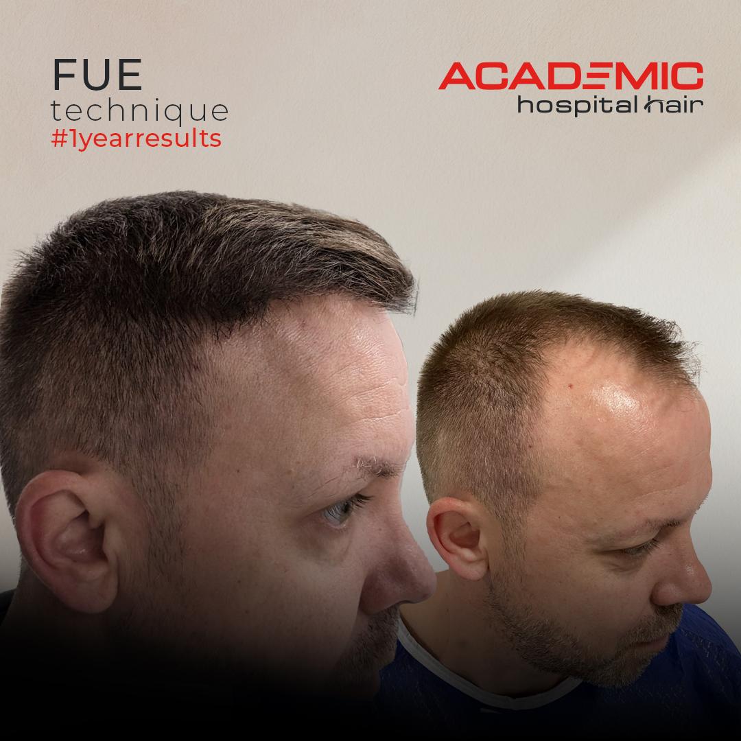 Eugen Koch_DHI_B-A-2