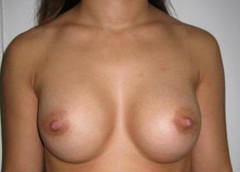  After / Despues / Après 08_A-min