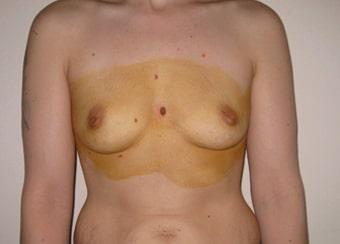 Before / Antes / Avant 11_B-min