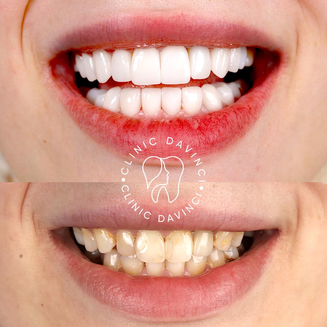 DA VINCI DENTAL RESULTS1