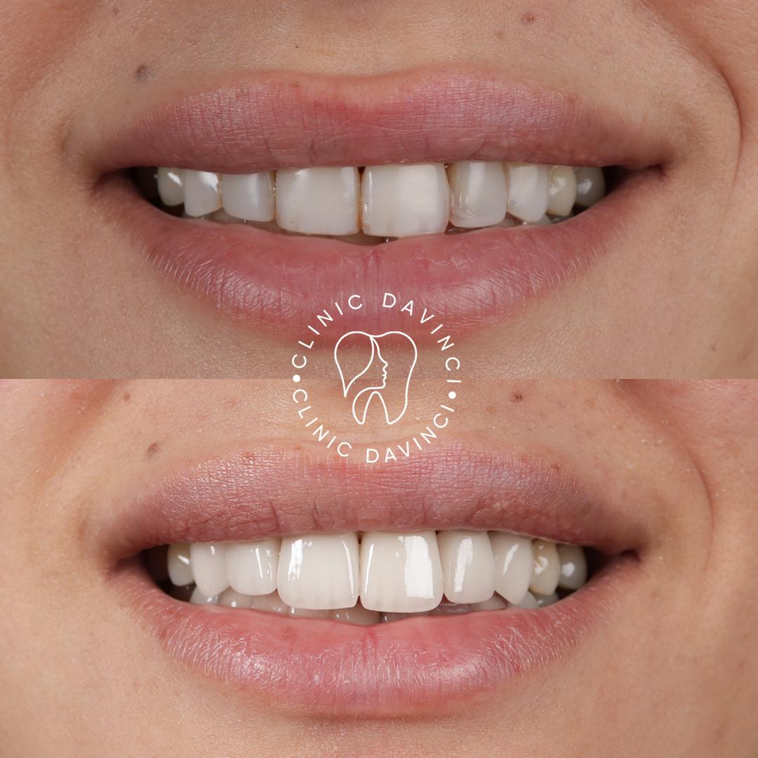 DA VINCI DENTAL RESULTS5