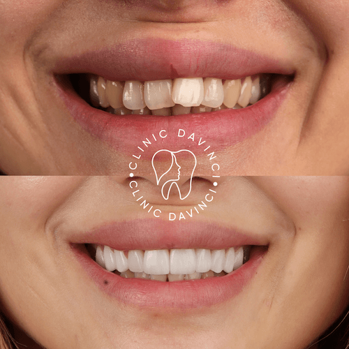 DA VINCI DENTAL RESULTS2