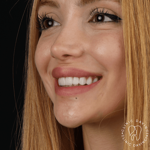 DA VINCI DENTAL RESULTS4