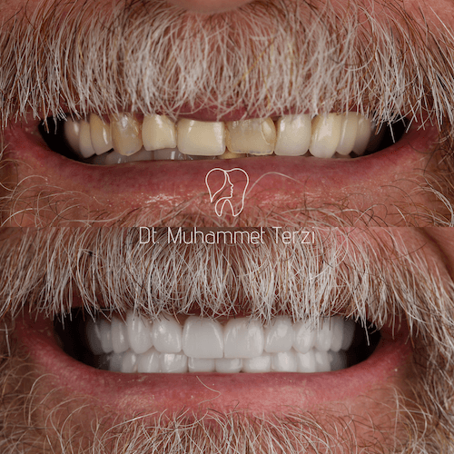 DA VINCI DENTAL RESULTS8