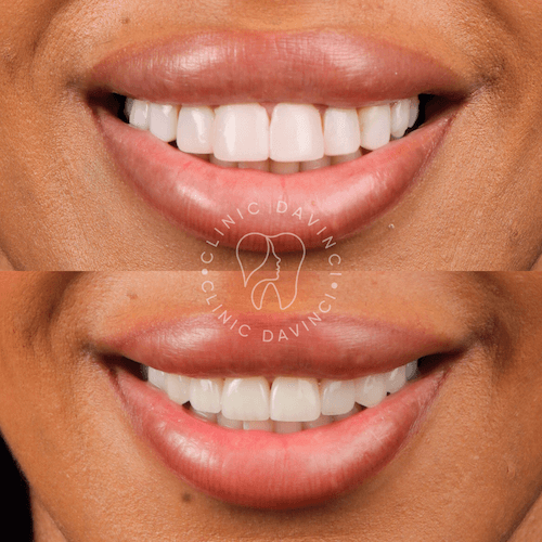DA VINCI DENTAL RESULTS9