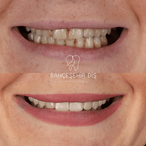 DA VINCI DENTAL RESULTS11
