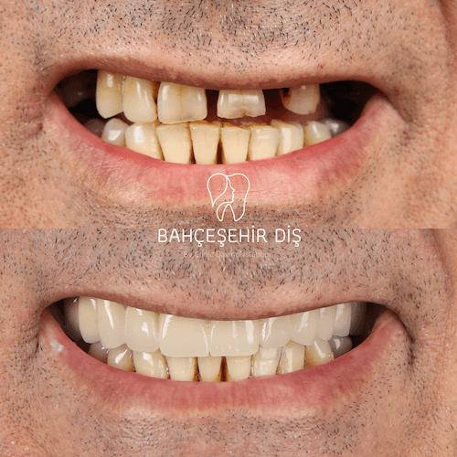 DA VINCI DENTAL RESULTS12