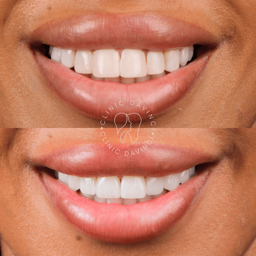 DA VINCI DENTAL RESULTS13