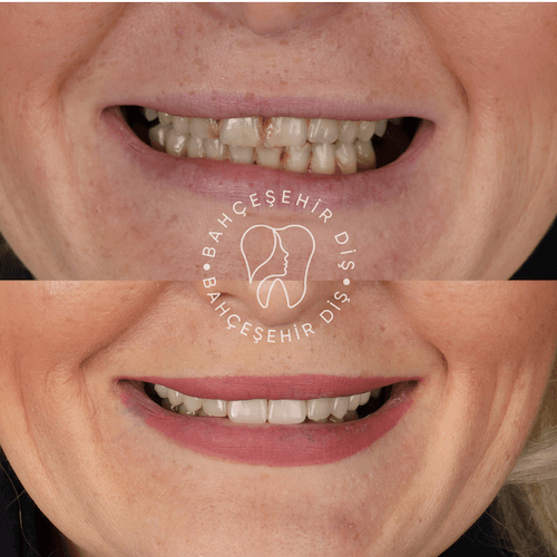 DA VINCI DENTAL RESULTS14