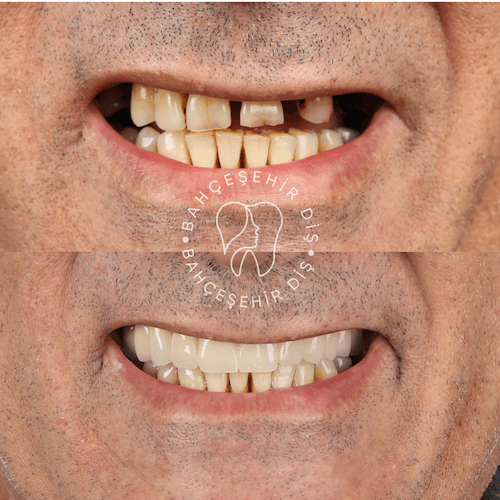 DA VINCI DENTAL RESULTS15