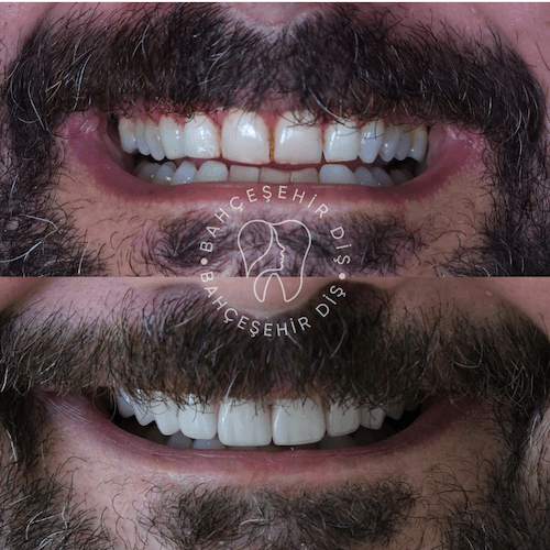 DA VINCI DENTAL RESULTS16