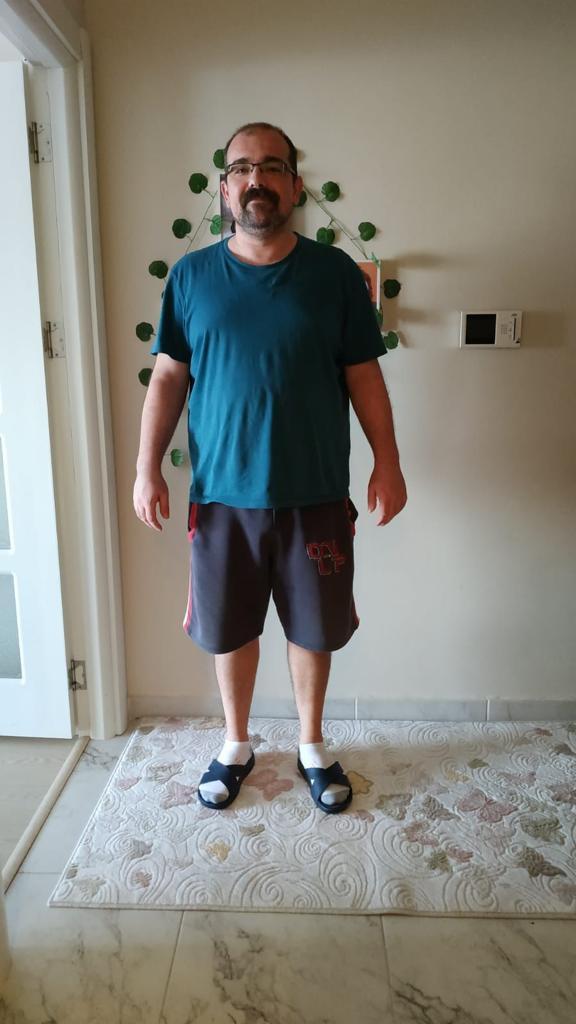 MEDICAL PARK PENDIK SLEEVE RESULTS 2