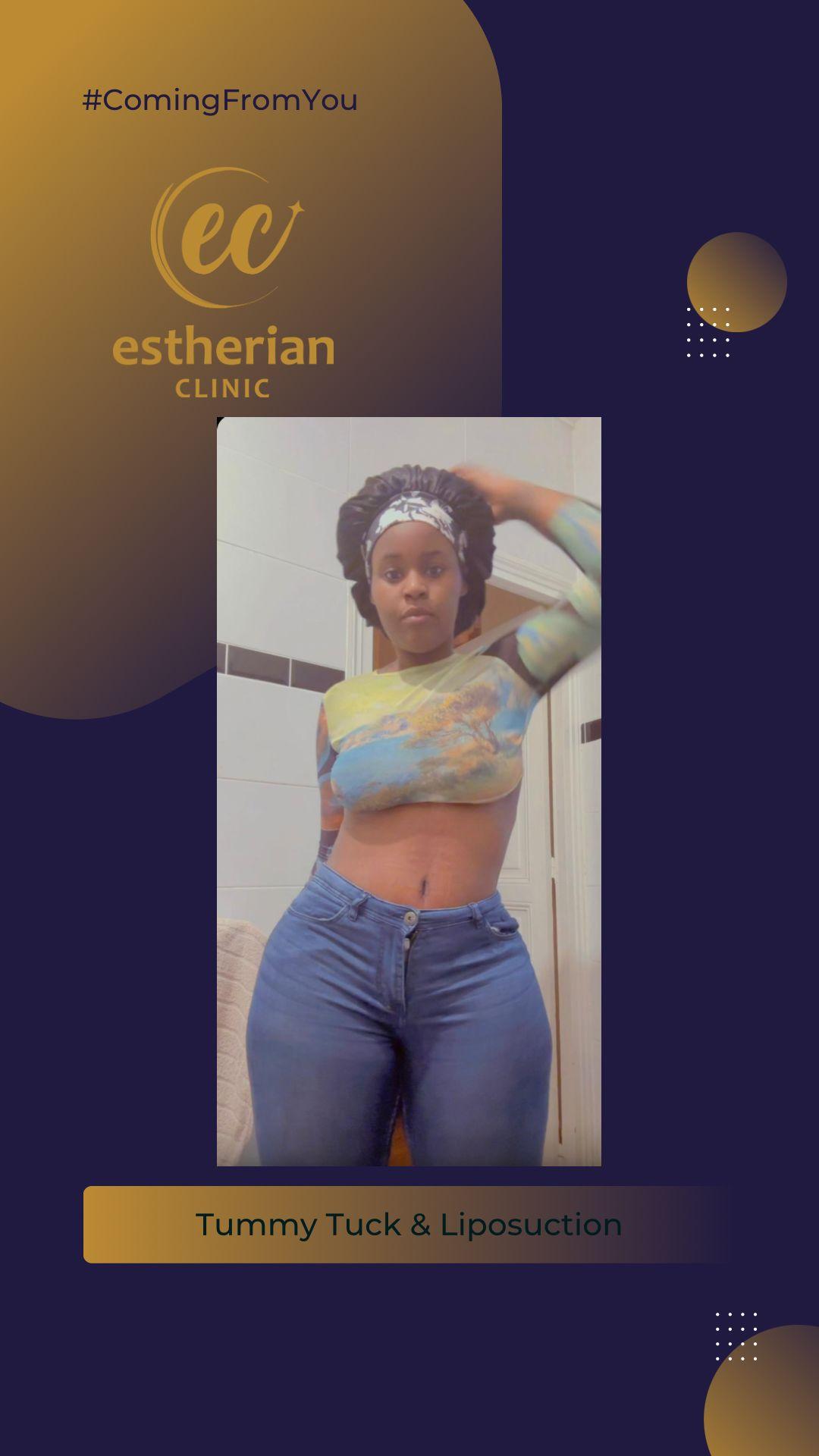 Estherian Clinic - Beauty Clinic Istanbul 