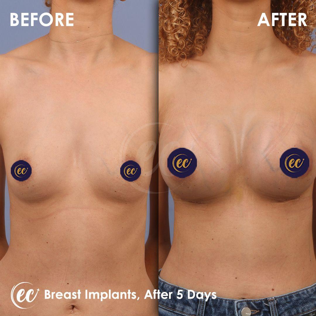 Estherian Clinic - Beauty Clinic Istanbul 