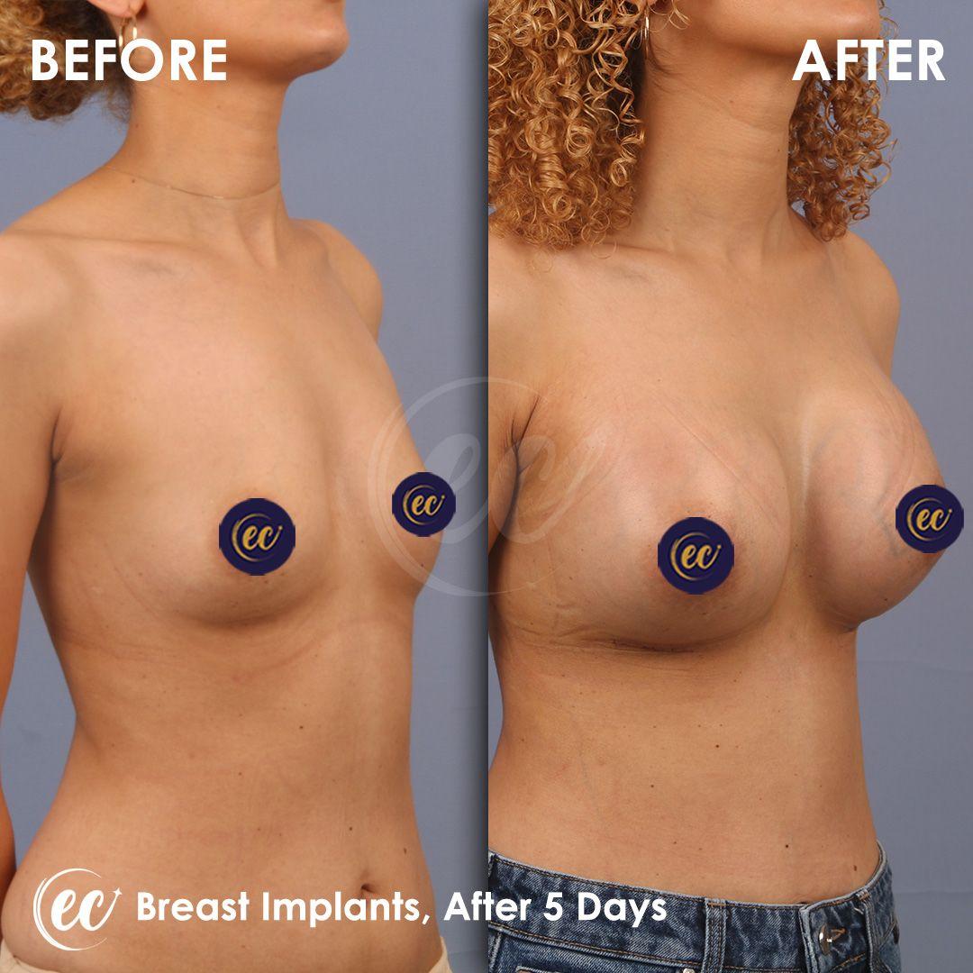 Estherian Clinic - Beauty Clinic Istanbul 