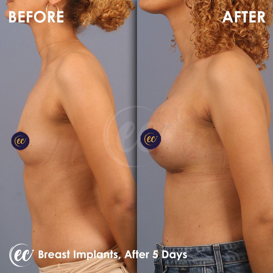 Estherian Clinic - Beauty Clinic Istanbul 