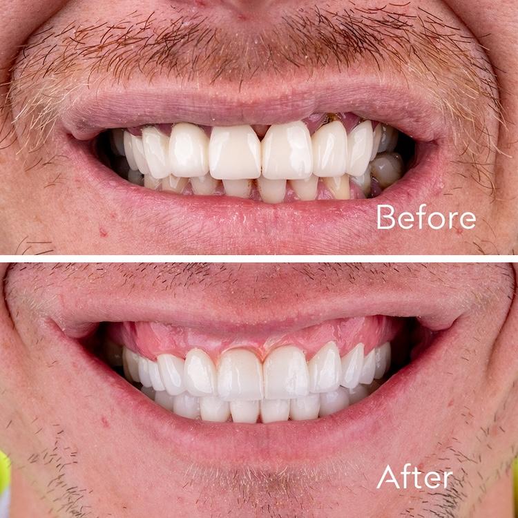 ZenSmileTown Dental Results22