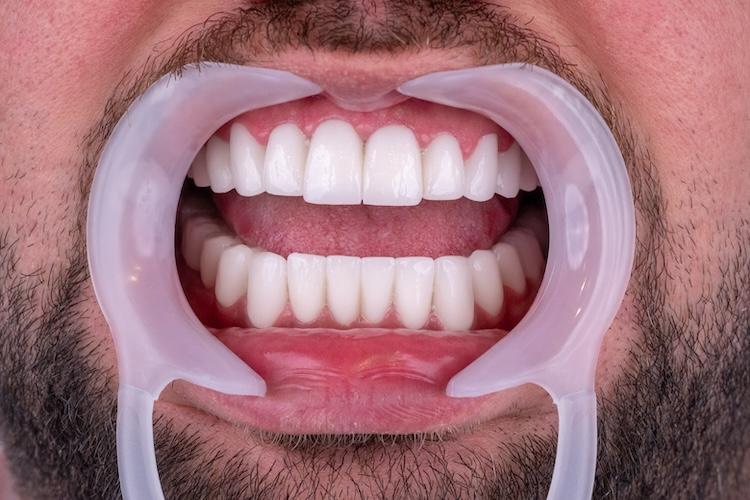 ZenSmileTown Dental Results29