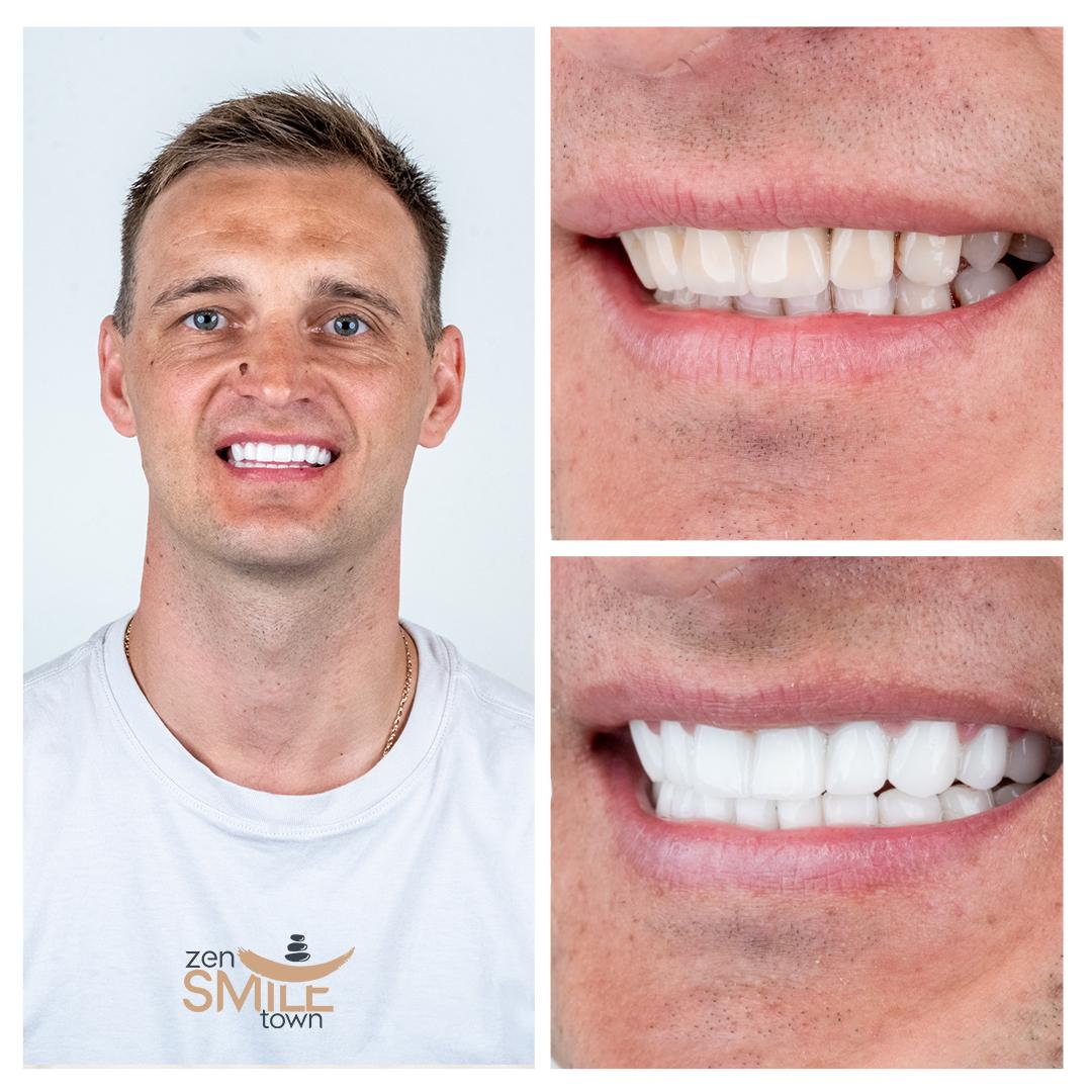 ZenSmileTown Dental Results37