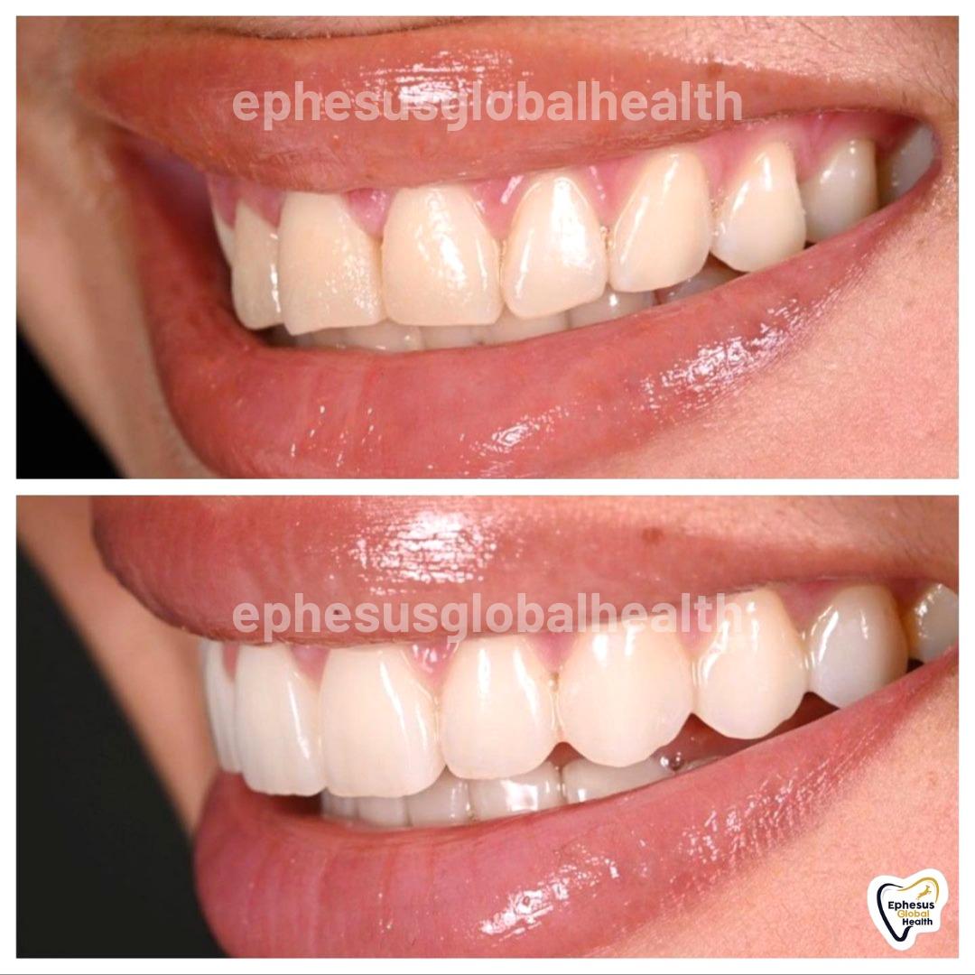Ephesus dental results38