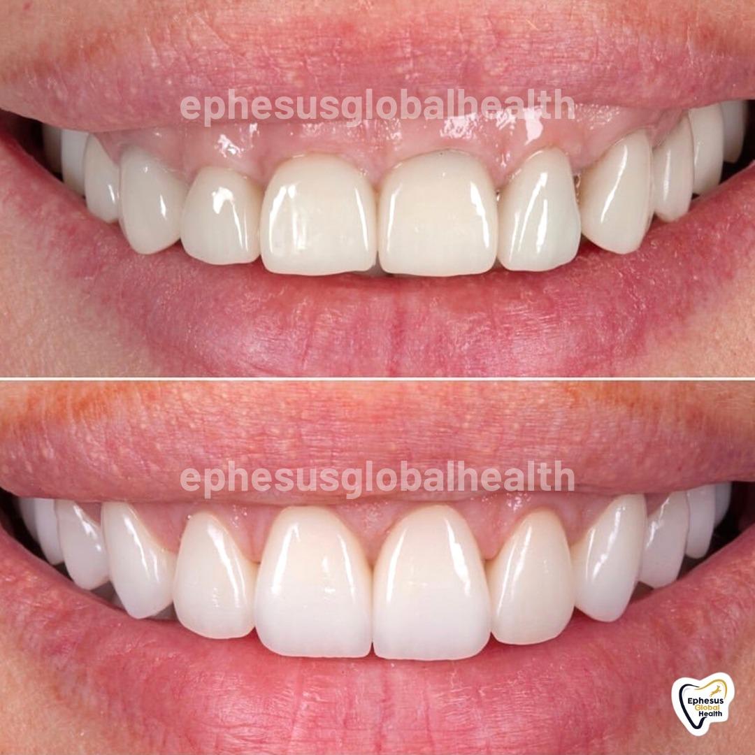 Ephesus dental results36