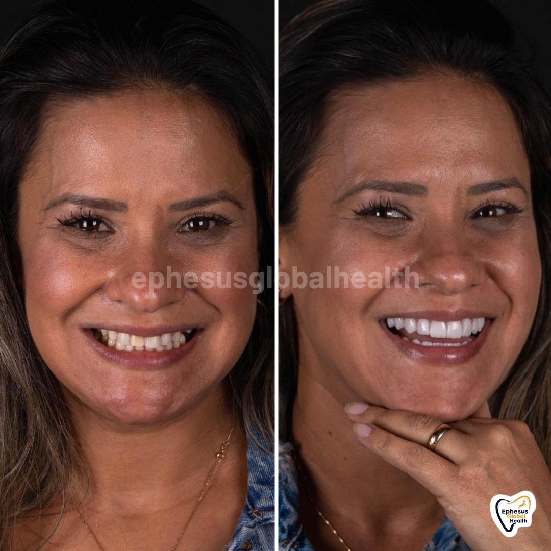 Ephesus dental results35