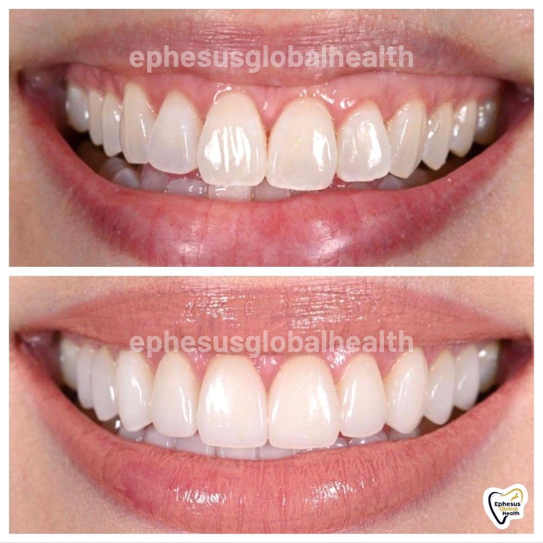Ephesus dental results34