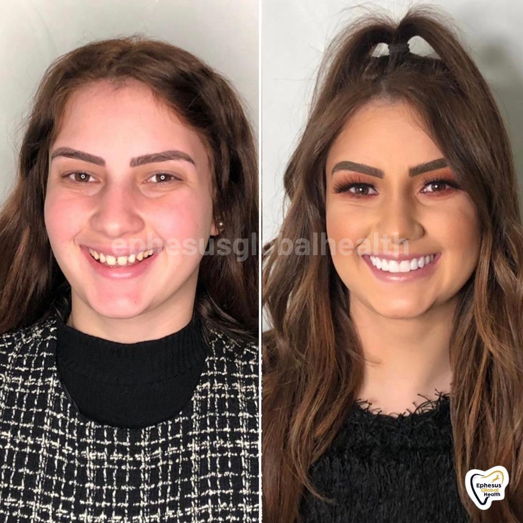 Ephesus dental results32