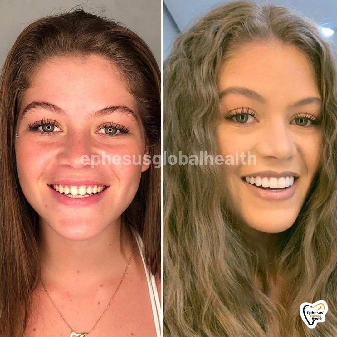 Ephesus dental results30