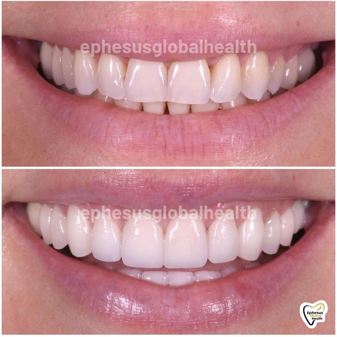 Ephesus dental results29