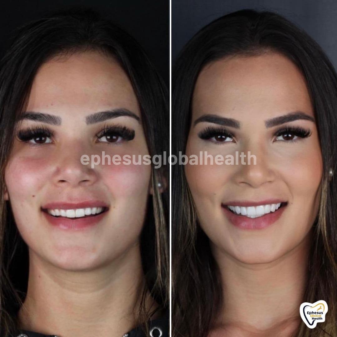 Ephesus dental results28