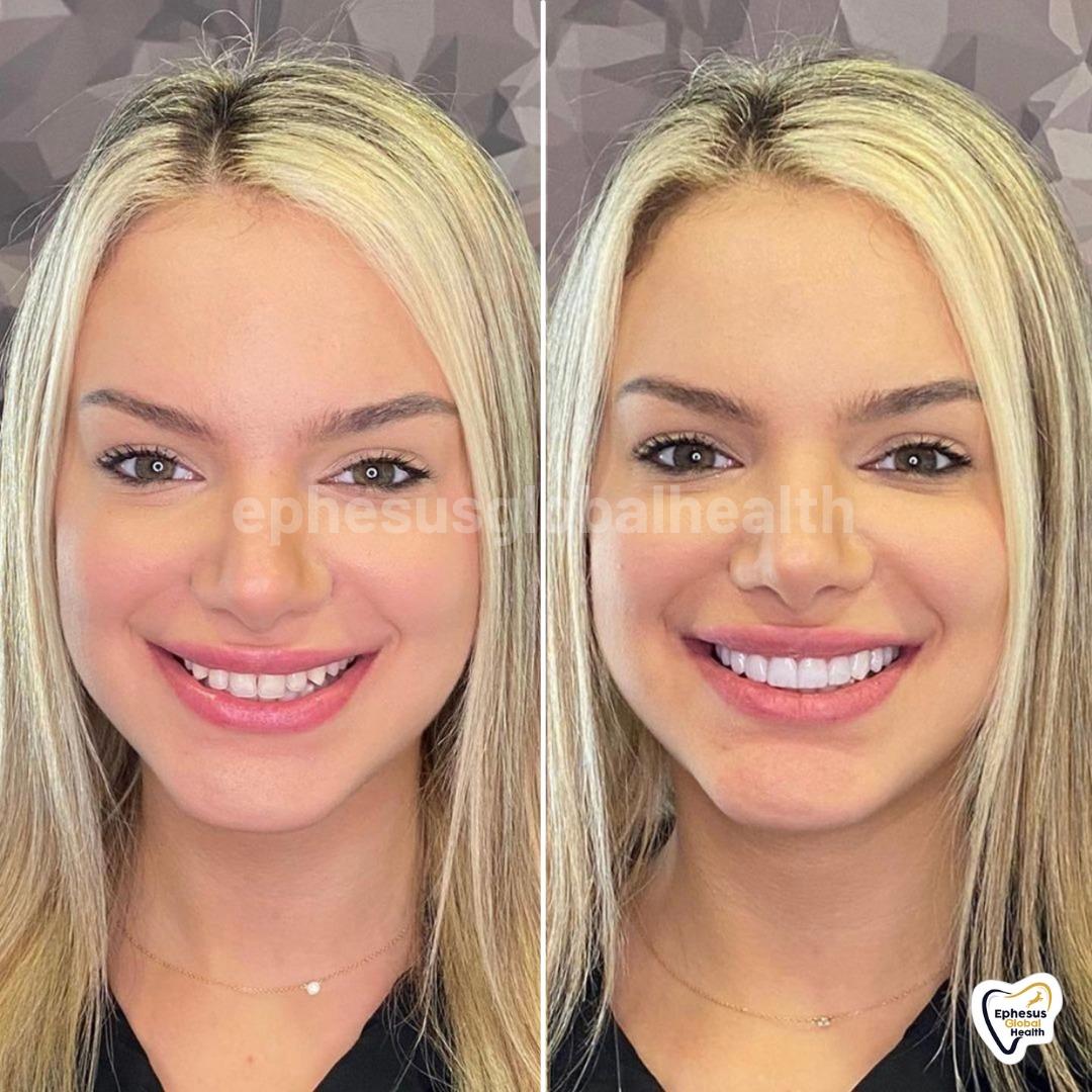 Ephesus dental results27